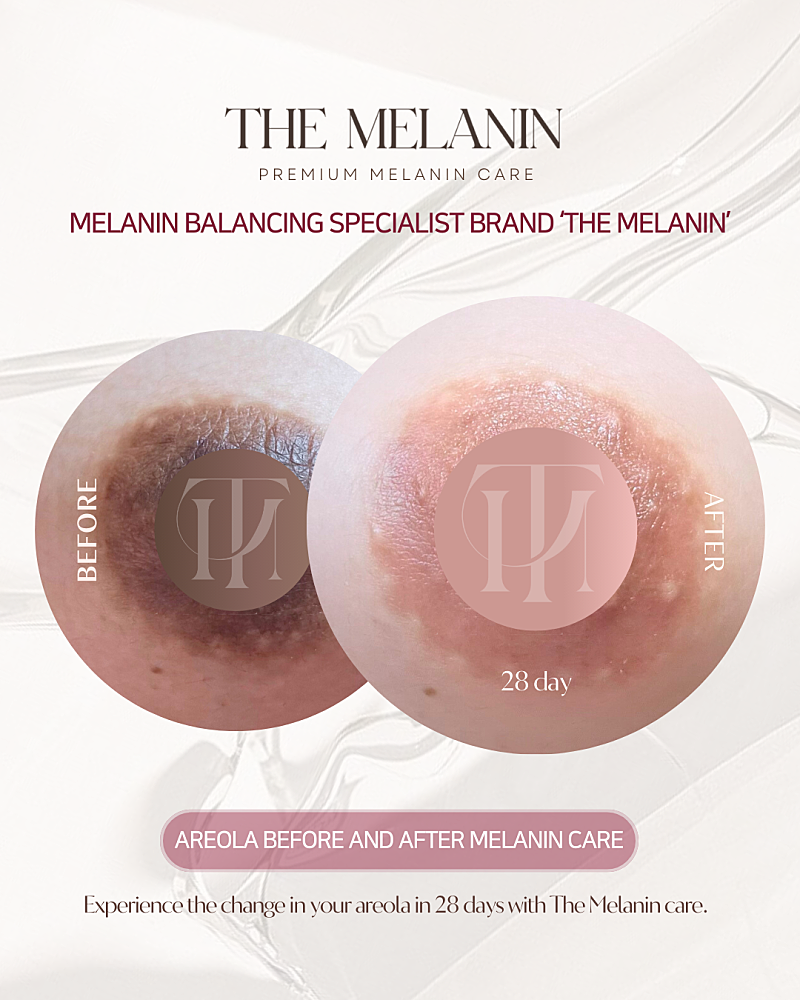 Understanding Melanin: How to Brighten Intimate Areas Safely