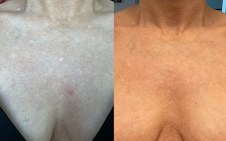 Cover-Up Cream Foundation