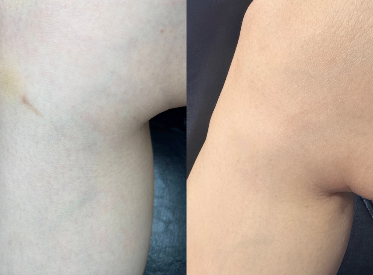 Cover-Up Cream Foundation